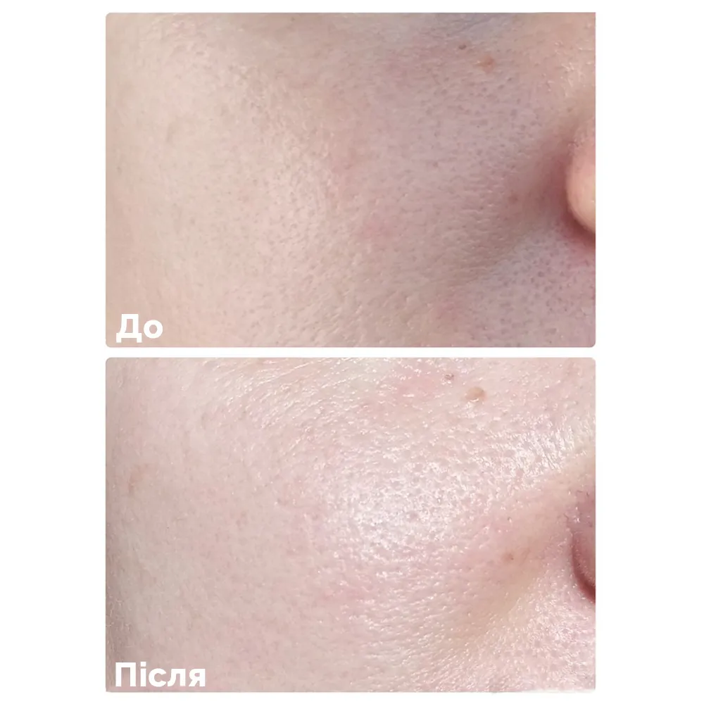 mild_cleansing_gel_needly-65297294847881